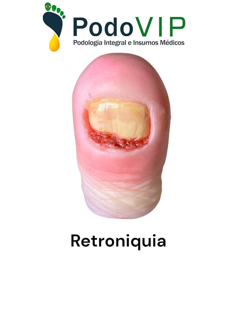 Retroniquia