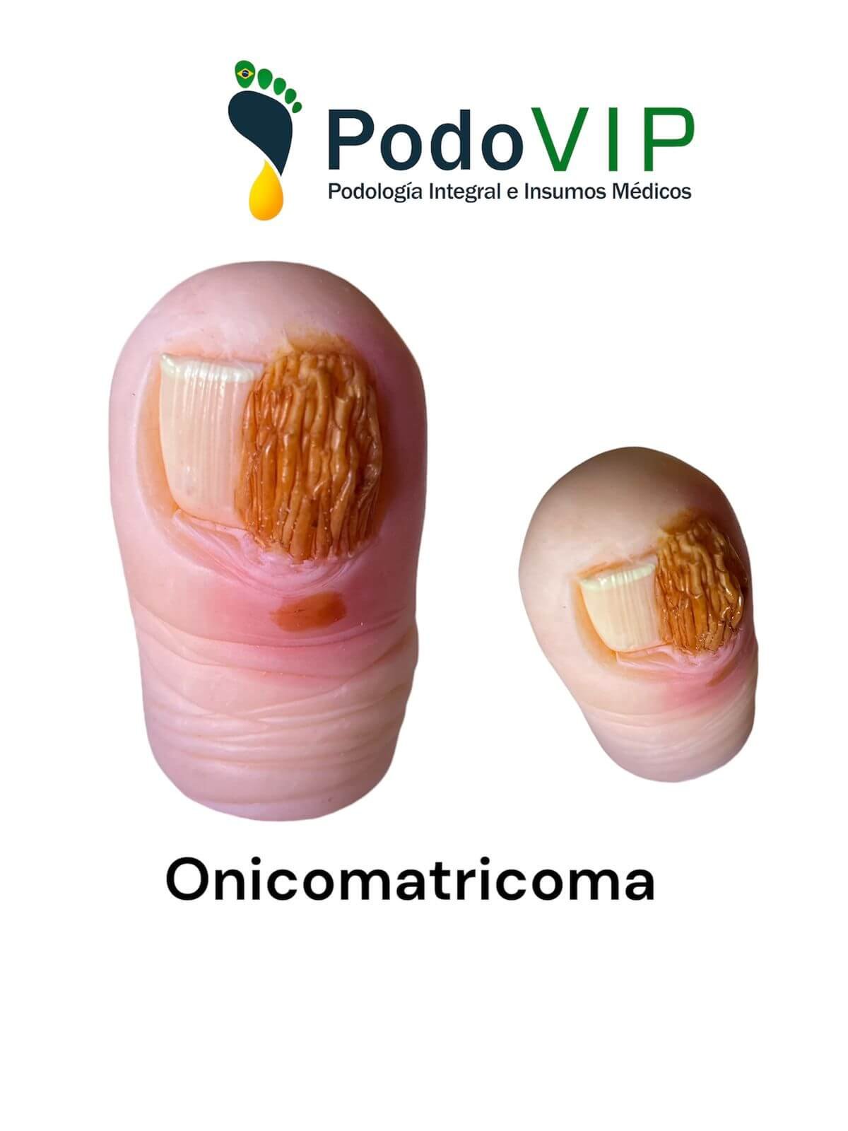 Onicomatricoma