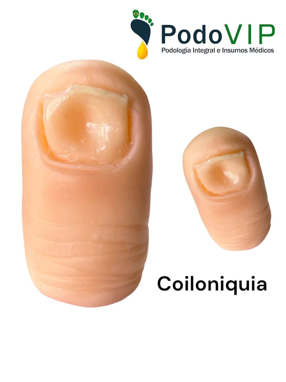 Coiloniquia
